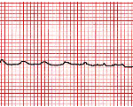 Diapositiva3