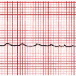 Diapositiva4